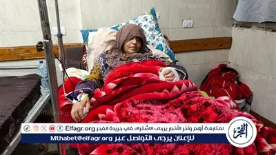 بعد إصابتها بكسر في الجمجمة.. ضحية اعتداء طليقها بطنطا تروي لـ«الفجر» تفاصيل الواقعة