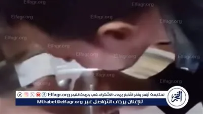 نقابة أسنان البحيرة توضح حقيقة فيديو علاج التسوس بالدخان