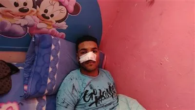 الاعتداء على شاب دافع عن فتيات من التحرش ببورسعيد.. إصابته بجروح خطيرة ومطالبات بسرعة ضبط المتهمين