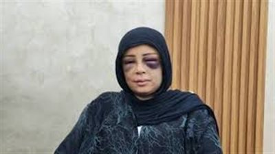 شوه وشها| محامي ضحية بورسعيد يكشف تفاصيل صادمة عن واقعة الاعتداء الوحشي